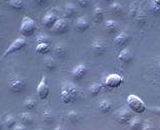 Embryonic Kidney Cells (EKC)