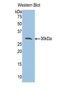 Polyclonal Antibody to Vesicle Associated Membrane Protein Associated Protein A (VAPA)