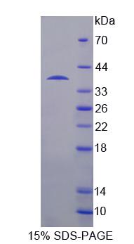 Recombinant USP6 N-Terminal Like Protein (USP6NL)