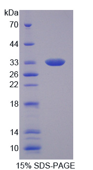 Recombinant Tumor Necrosis Factor Alpha Induced Protein 6 (TNFaIP6)
